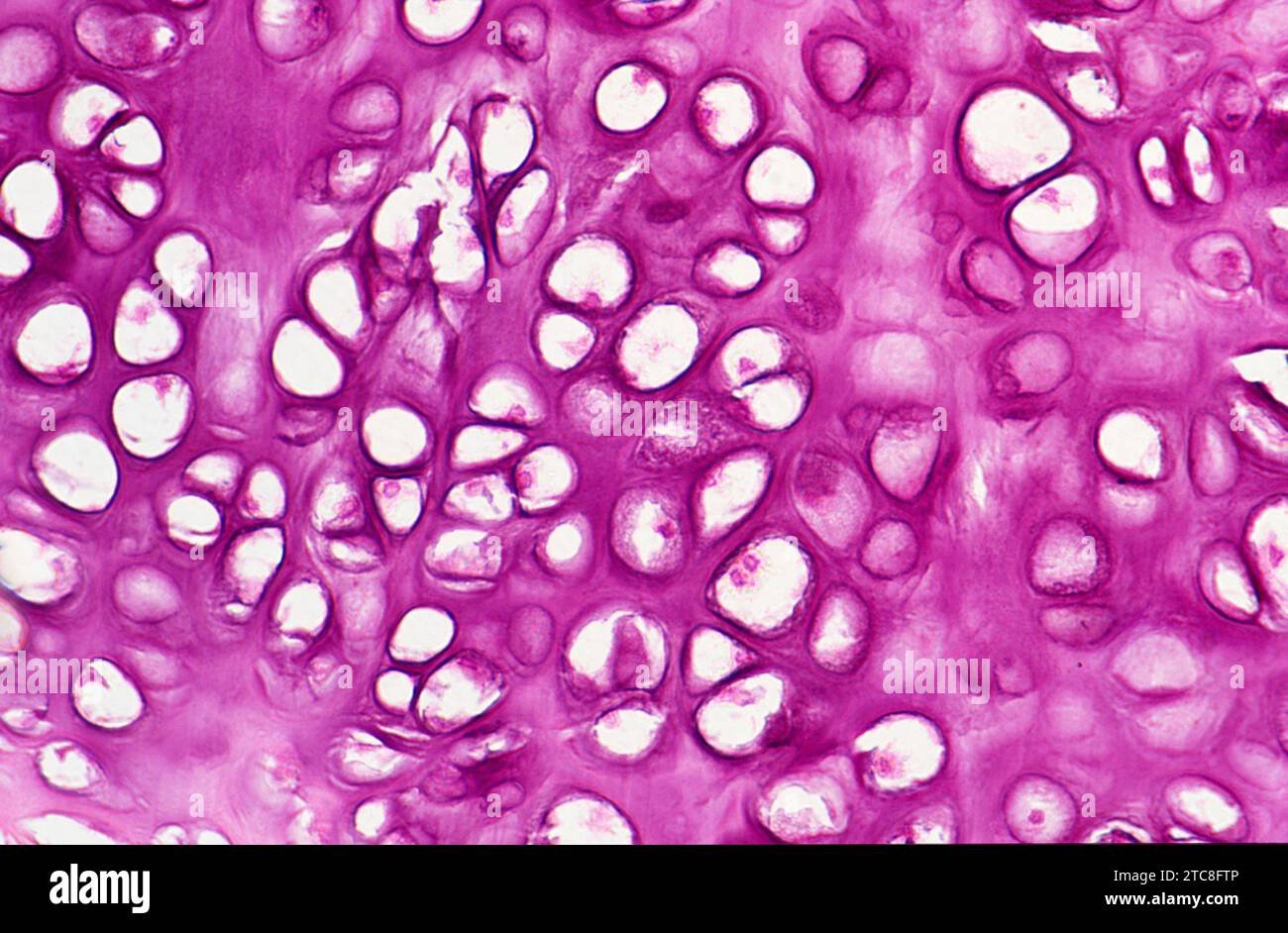 The Best Recovery Routine After Cartilage Surgery